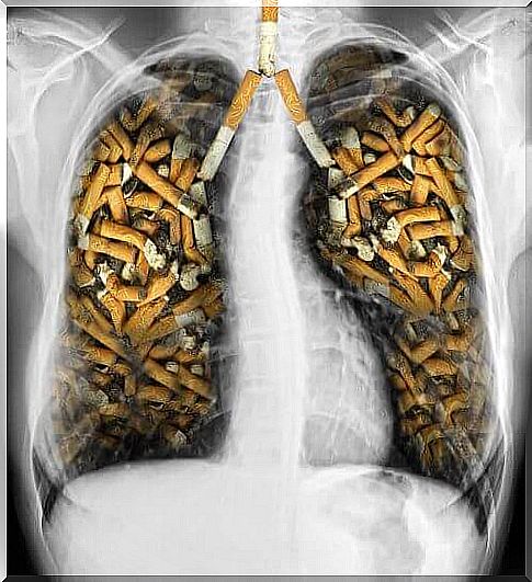 cigarettes