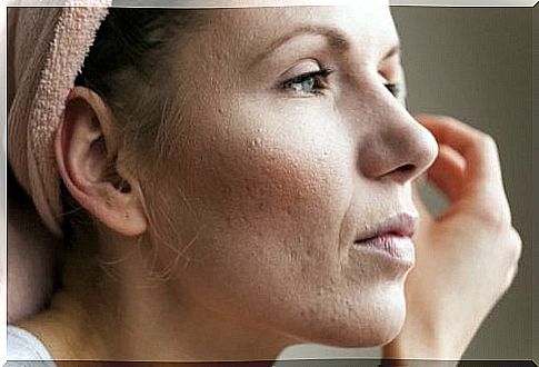 8 tips for shrinking enlarged pores