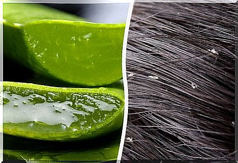 Effective and easy ways to get rid of dandruff