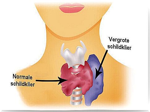 abnormal thyroid