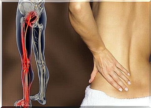 What are the symptoms of sciatica pain