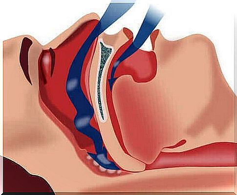 Habits to help you cope with sleep apnea