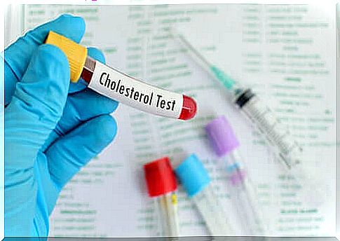 HDL and LDL cholesterol: everything you need to know