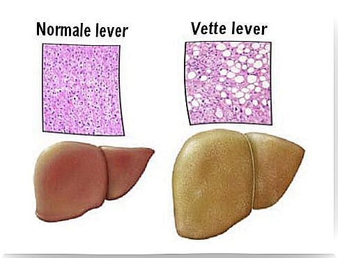 Properties of a fatty liver