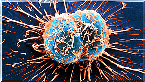 How the immune system fights cancer