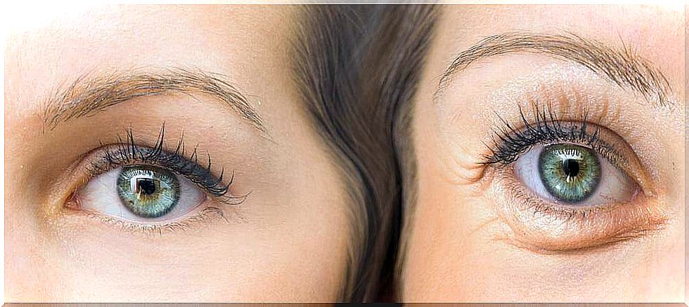 Lift droopy eyelids with five natural ingredients