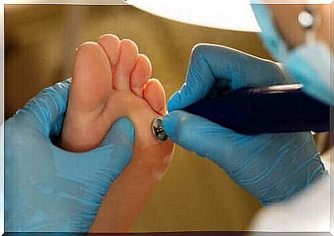 Medical treatment of calluses on hands and feet