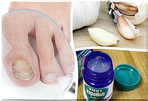 Seven remedies against fungal nails