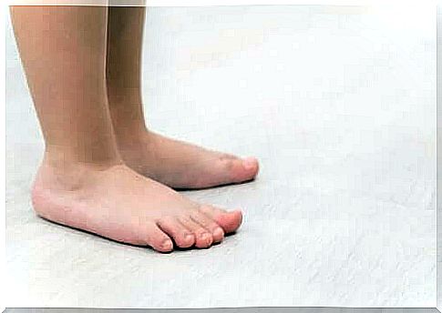 The characteristics and treatment of flat feet