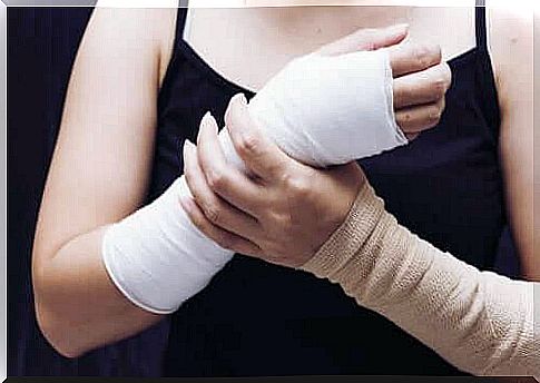 A woman with a broken wrist